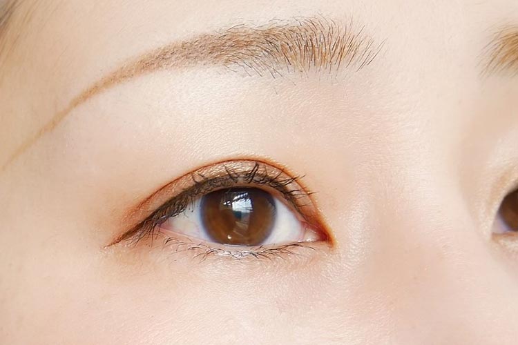 一般眼科のイメージ写真